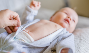 Caring for Your Newborn's Umbilical Cord Stump